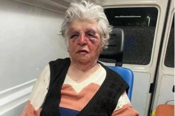 DETALJI BRUTALNOG NAPADA NA BAKU BOŽANU U SEVERNOJ MITROVICI: Napadači su govorili ALBANSKI