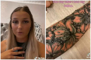 Imala je savršenu tetovažu, A ONDA JE 24 SATA KASNIJE IZ NJE NEŠTO POČELO DA IZLAZI! Ruka joj je otekla, više nije mogla da je savije... (VIDEO)