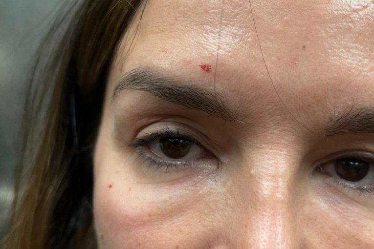 Severina nakon tuče sa sestrom