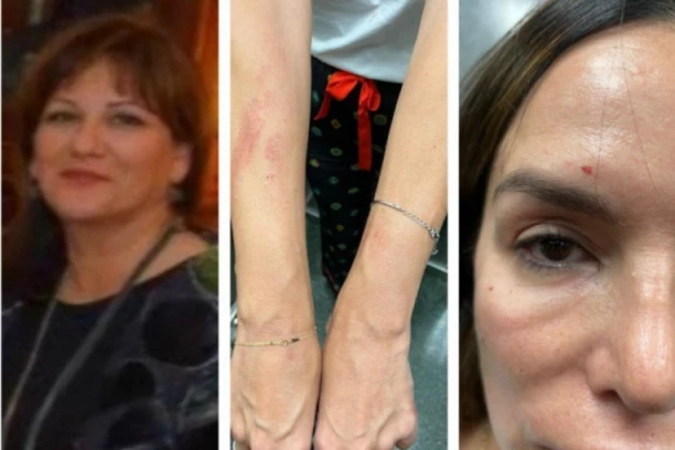 Ekskluzivna ispovest Severinine sestre: "Ona može da ubije dete ili sebe pod dejstvom droge"