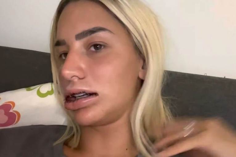 Aleksandra Nikolić nakon vađenja silikona