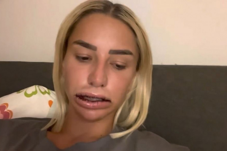 Aleksandra Nikolić pokazala usne nakon vađenja biopolimera