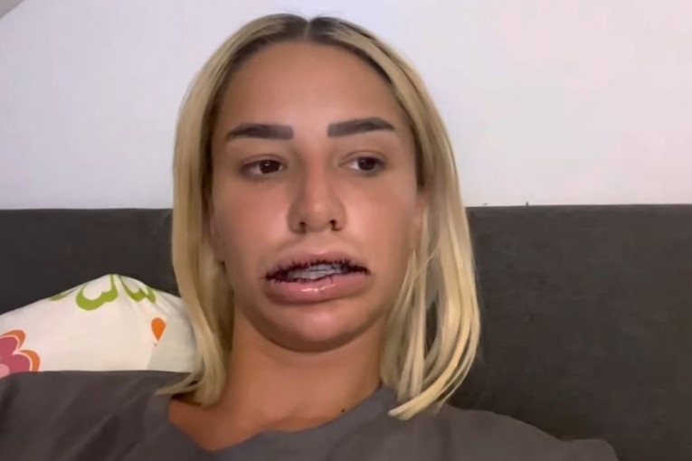 Aleksandra Nikolić nakon operacije