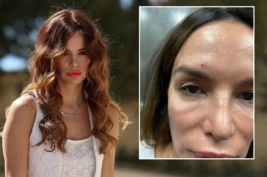 Ne želi da prihvati POMOĆ PSIHIJATRA, NASRTALA je i na bivše PARTNERE! Severina ponovo uhvaćena u LAŽI, jedan DETALJ na fotografijama otkriva SVE!