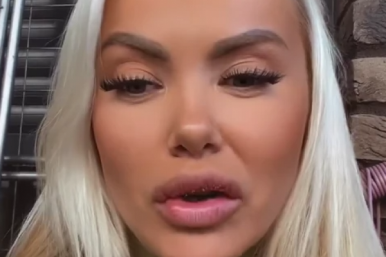 Sanja Stanković izvadila silikon