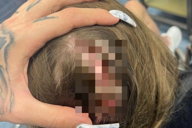 Sara Hadžić, povrede 