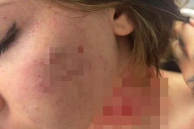 "Pretukao je moju sestru i njenu bebu, pa se na VMA krije iza tatice": Uznemirujuće fotke posle novog nasilja u porodici