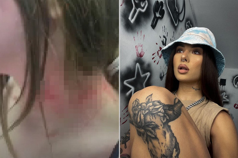 Sestra Uki Q pretučena