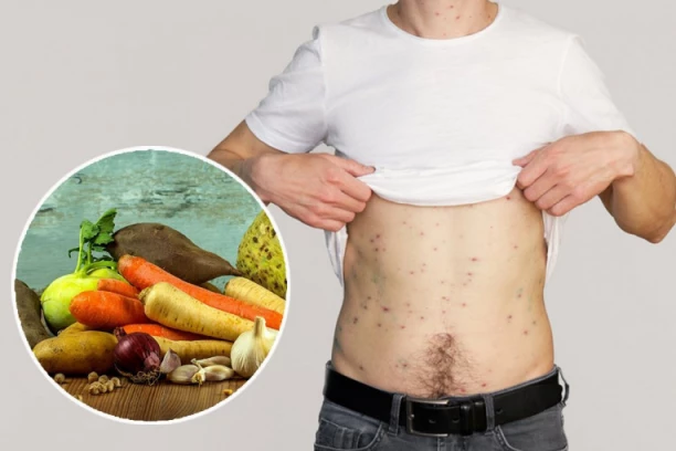 PA ŠTA DA JEDE?! Za njega pica, sirevi i meso ne postoje: Čovek se razboli svaki put kada pojede povrće, OVO SU SIMPTOMI!