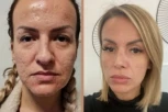 Ermina Pašović PROMENILA LIČNI OPIS: Bivša zadrugarka nakon estetskih operacija NEPREPOZNATLJIVA, pokazala kako sada izgleda! (FOTO)