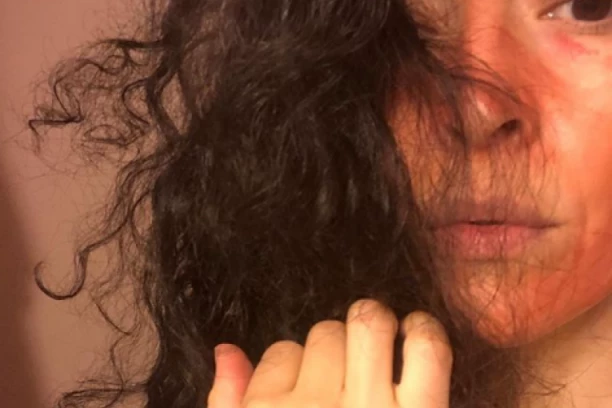 POTPUNO BIZARNO: Žena menstrualnu krv maže po licu, tvrdi da joj je to posebno pomoglo zbog ovoga!