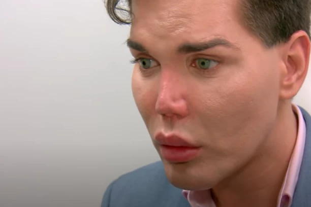 KADA JE POSTAO KAO KEN, IPAK JE ODLUČIO DA BUDE ŽENA: Džesika uradila preko 70 operacija, svi zabrinuti za nju!