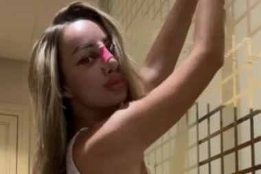 Macu Diskreciju zavrnuo PLASTIČAR, napravio joj nos k'o Pinokiju: Starleta neprepoznatljiva, skinula zavoje, a rezultat zahvata ŠOKIRAJUĆ! (FOTO)