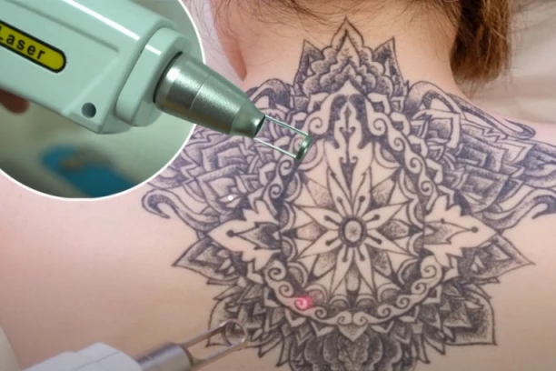 URADILI STE TETOVAŽU KOJA VAM SE NE DOPADA? Bili smo u SALONU da vi ne biste morali, a cene će vas ŠOKIRATI (FOTO,VIDEO)