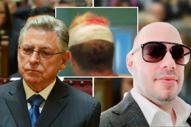 UDARNO SAOPŠTENJE MUP! Policija se oglasila o prebijanju sina Zorana Lilića (VIDEO)