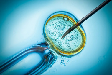 ZBOG ČEGA SPERMU UVOZIMO IZ INOSTRANSTVA: Reproduktivne ćelije nam stižu iz Španije