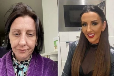 EMA (42) SE RAZVELA, A ONDA JE PROCVETALA: Evo kako je izledala pre, transformacija je nemoguća