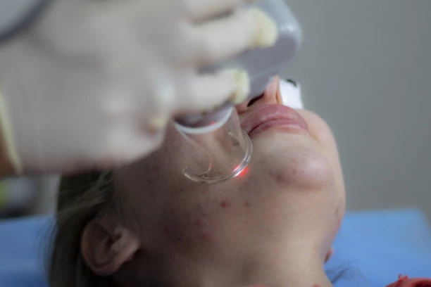 "LJUDI SU SE PITALI DA LI IMAM RETKU KOŽNU BOLEST": Zbog akni otišla u bolnicu, OBOŽAVA gužvu da joj niko ne bi primetio lice!