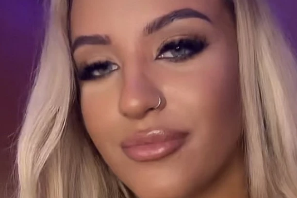 UBRIZGALA 13 MILILITARA HIJALURONA U USNE I IZGLEDA KAO DA ĆE "PUĆI": Svi se pitaju zašto to radi, a ona oduševljena (VIDEO)