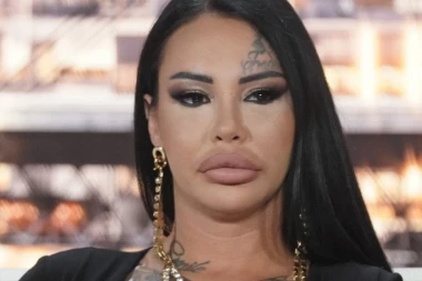 HITNA OPERACIJA, PUKAO JOJ SILIKON! Anđela Veštica prolazi kroz PAKAO: Starleta u strahu za zdravlje, preti joj JEZIVA DEFORMACIJA dojke!