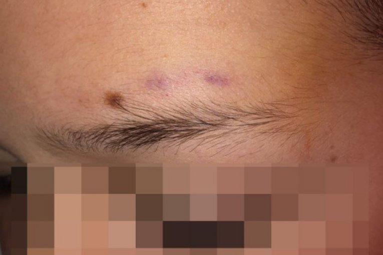 Vršnjačko nasilje, Vranje