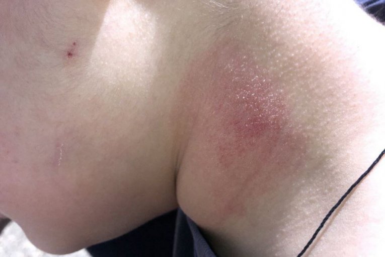 Vršnjačko nasilje, Vranje