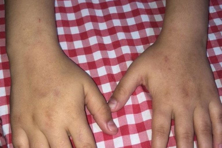 Vršnjačko nasilje, Vranje