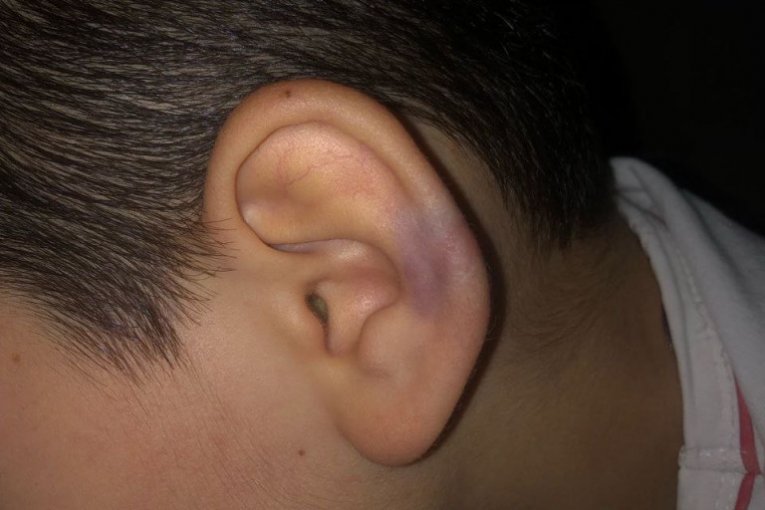 Vršnjačko nasilje, Vranje