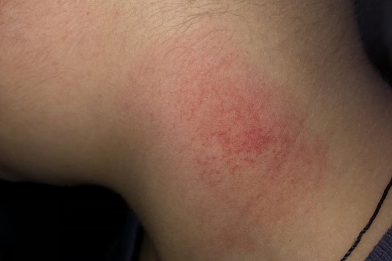 Vršnjačko nasilje, Vranje