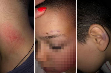 "MAMA, NISAM IMAO IZBORA TRAŽIO SAM PROZOR DA SKOČIM" Reč stručnjaka o slučaju vršnjačkog nasilja u Vranju: To je odraz vremena u kom živimo, TREBA NEGOVATI LEPO (UZNEMIRUJUĆE FOTOGRAFIJE)