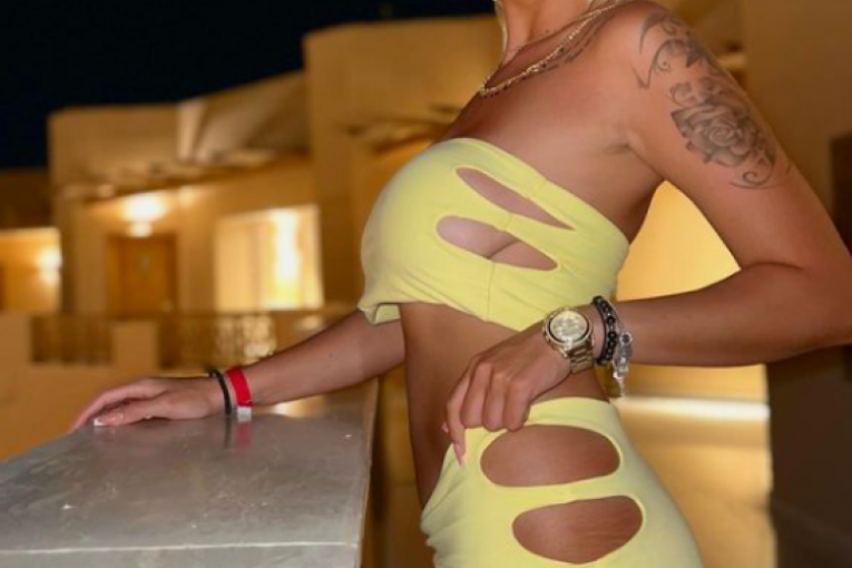 Aleksandra Nikolić pre vađenja silikona