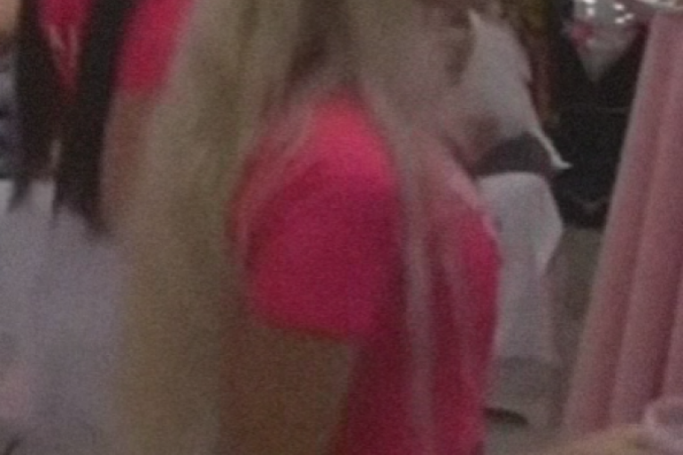 Aleksandra Nikolić posle vađenja silikona