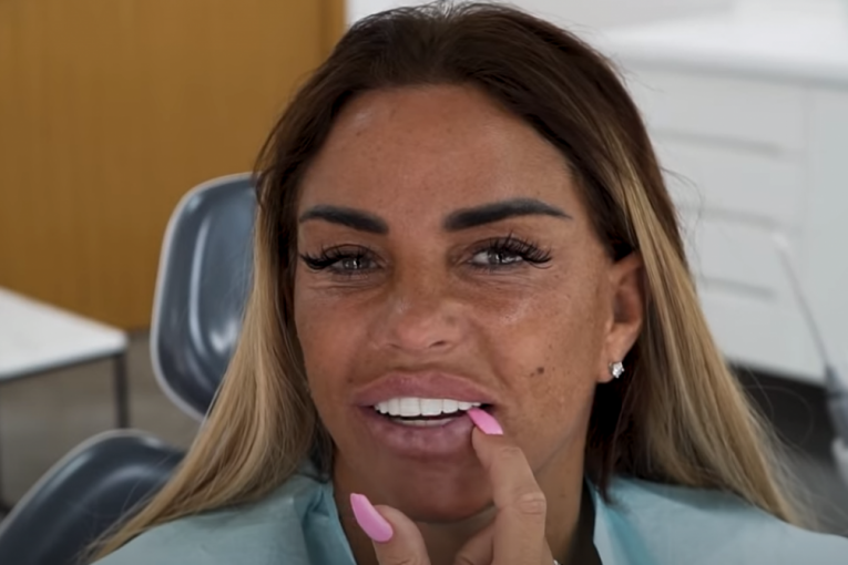 Kejt Prajs radi zube