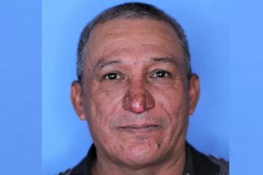 MORAO DA NOSI MASKU OD SRAMOTE: Nos ovog čoveka je poprimio oblik polnog organa, svi su buljili u njega non-stop (FOTO)