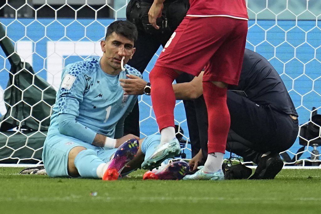 Povreda golmana Irana protiv Engleske