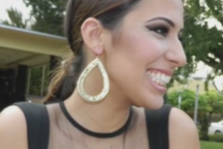 Dunja Jovanić pre plastičnih operacija