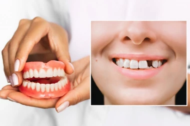 POSTAJEMO BEZUBA NACIJA! Više od 700.000 Srba nema nijedan svoj zub u glavi, a što je najgore, među njima je sve više mladih!