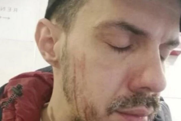 NAŠ PEVAČ IDE HITNO NA LEČENJE: Pronađeno njegovo OPROŠTAJNO PISMO, javnost u suzama!