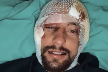 JEZIVE SCENE NAKON UDESA: Povređeni zadrugar objavio stravične snimke slupanog automobila! (FOTO)