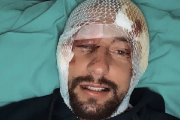 JEZIVE SCENE NAKON UDESA: Povređeni zadrugar objavio stravične snimke slupanog automobila! (FOTO)