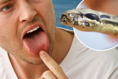 RUŽNO SANJAO PA OTIŠAO KOD ASTROLOGA: Odsekli mu jezik - krv šikljala na sve strane, lekari u šoku!