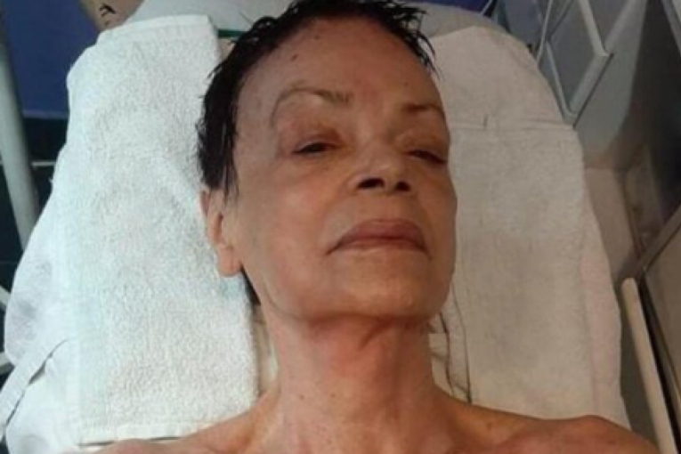 Ruška Jakić bez šminke