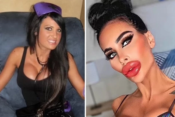 NJU ZOVU KRALJICOM PLASTIČNE HIRURGIJE: Muškarci oduševljeni, novim videom pokazala BAŠ PREVIŠE, a sada se priprema za novu turu operacija! (VIDEO)