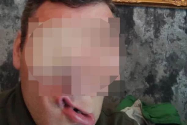 PROTIV POZNATOG PEVAČA PODIGNUTA OPTUŽNICA! Nakon svađe posle nastupa izbo dva gosta, jedan ostao bez BUBREGA, pakao!