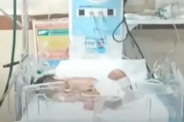 LEKARI U ŠOKU NAKON ROĐENJA BEBE, NISU MOGLI DA VERUJU ŠTA VIDE: Snimak novorođenčeta obišao svet (VIDEO)