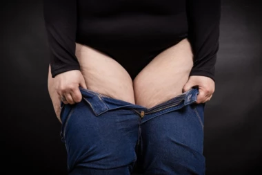 MOŽETE SE ZAHVALITI SALU NA BUTINAMA I CELULITU: Ono što žene najviše mrze štiti od čak DVE ozbiljne bolesti!