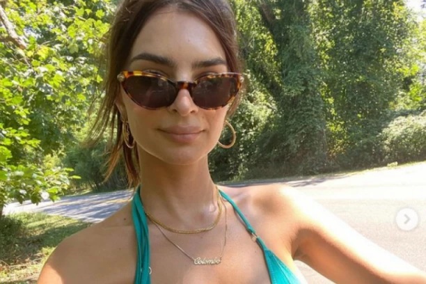 NAJZGODNIJA ŽENA NA SVETU OTKRILA JE TAJNU SVOG IZGLEDA: Potrebna su vam samo DVE namirnice koje sigurno već imate u kući, PRŽE masnoću!