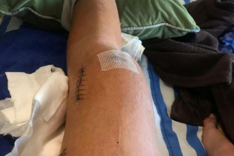 Bilal Brajlović pokazao povrede