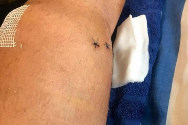 Bilal Brajlović pokazao povrede