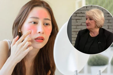 TRI PUTA VIŠE SRBA PATI OD ALERGIJE NA HLADNOĆU! Doktorka Obradović iznela dramatične podatke: LJUDSKI ORGANIZAM JE DEVASTIRAN, OKRUŽENI SMO TOKSINIMA!